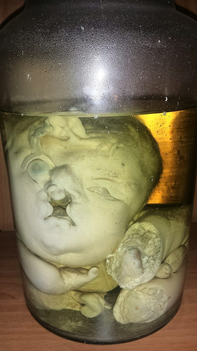 Antonio Cardarelli's Hospital anatomical preparations (9).jpg